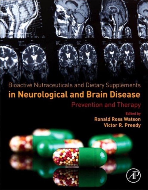 Bioactive Nutraceuticals and Dietary Supplements in Neurological and Brain Disease : Prevention and Therapy, EPUB eBook