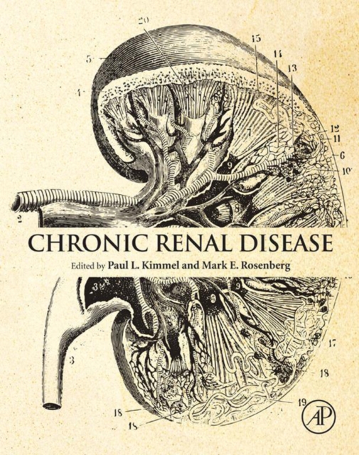 Chronic Renal Disease, EPUB eBook