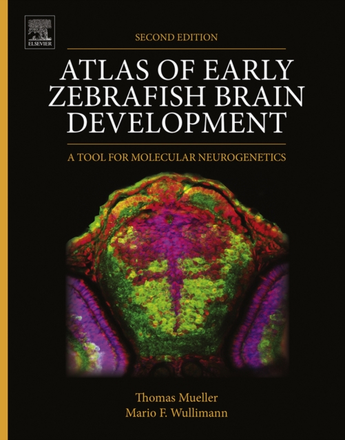 Atlas of Early Zebrafish Brain Development : A Tool for Molecular Neurogenetics, EPUB eBook