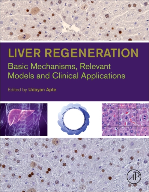 Liver Regeneration : Basic Mechanisms, Relevant Models and Clinical Applications, Hardback Book