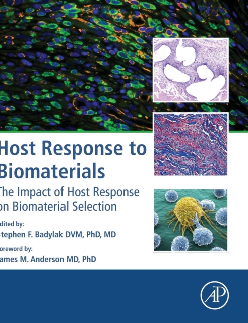 Host Response to Biomaterials : The Impact of Host Response on Biomaterial Selection, Hardback Book