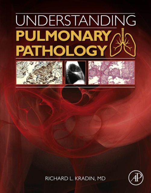 Understanding Pulmonary Pathology : Applying Pathological Findings in Therapeutic Decision Making, EPUB eBook