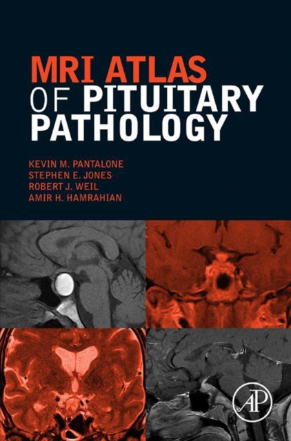 MRI Atlas of Pituitary Pathology, EPUB eBook