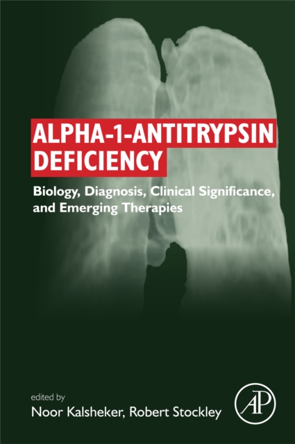 Alpha-1-antitrypsin Deficiency : Biology, Diagnosis, Clinical Significance, and Emerging Therapies, EPUB eBook