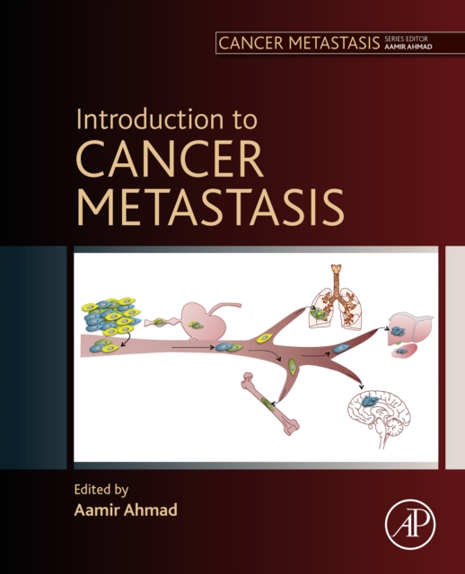 Introduction to Cancer Metastasis, EPUB eBook