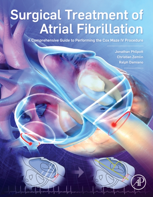 Surgical Treatment of Atrial Fibrillation : A Comprehensive Guide to Performing the Cox Maze IV Procedure, EPUB eBook