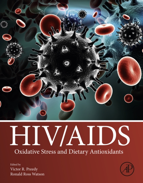 HIV/AIDS : Oxidative Stress and Dietary Antioxidants, EPUB eBook