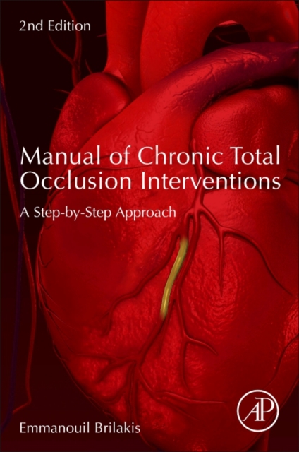 Manual of Chronic Total Occlusion Interventions : A Step-by-Step Approach, Paperback / softback Book