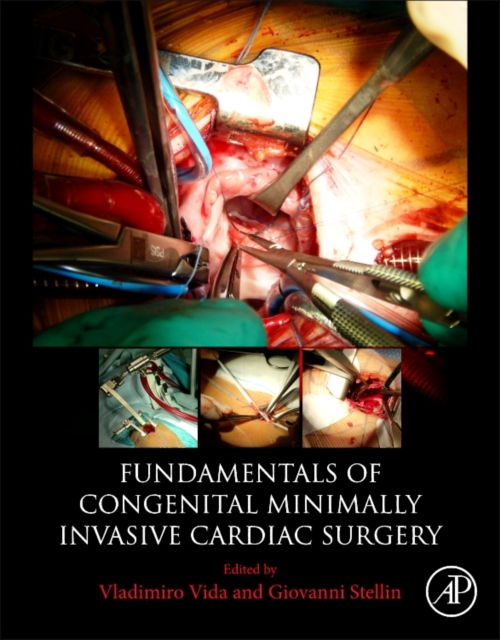 Fundamentals of Congenital Minimally Invasive Cardiac Surgery, Paperback / softback Book