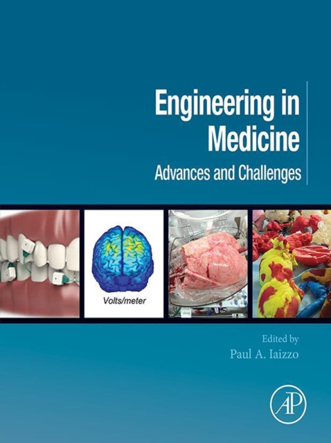 Engineering in Medicine : Advances and Challenges, EPUB eBook