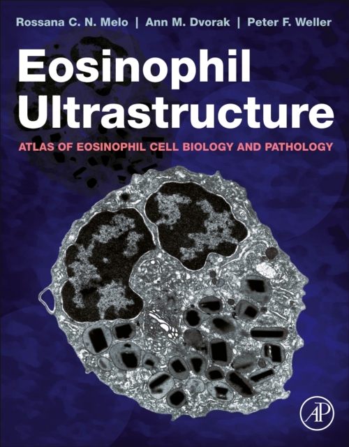 Eosinophil Ultrastructure : Atlas of Eosinophil Cell Biology and Pathology, Paperback / softback Book