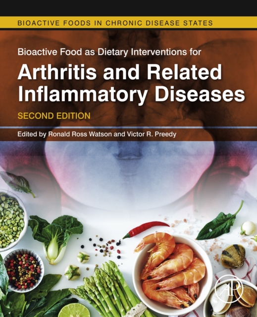 Bioactive Food as Dietary Interventions for Arthritis and Related Inflammatory Diseases, EPUB eBook