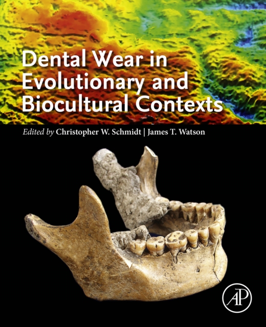 Dental Wear in Evolutionary and Biocultural Contexts, EPUB eBook