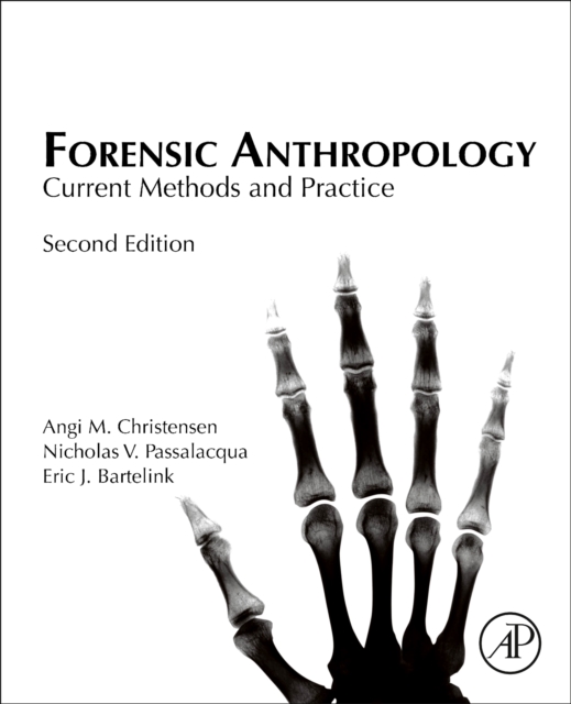 Forensic Anthropology : Current Methods and Practice, Hardback Book