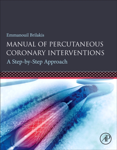 Manual of Percutaneous Coronary Interventions : A Step-by-Step Approach, Paperback / softback Book