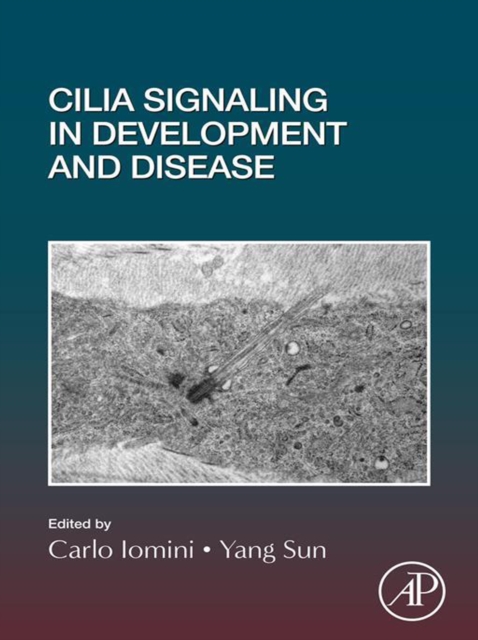 Cilia Signaling in Development and Disease, EPUB eBook