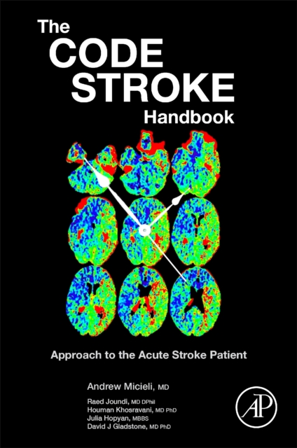 The Code Stroke Handbook : Approach to the Acute Stroke Patient, Paperback / softback Book