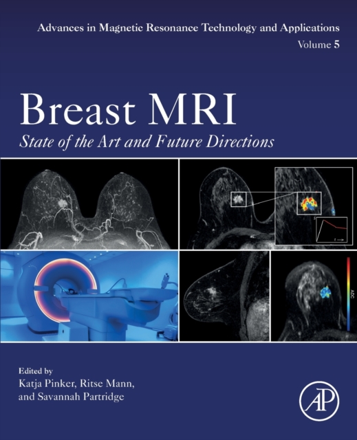 Breast MRI : State of the Art and Future Directions Volume 5, Paperback / softback Book