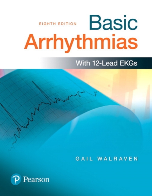 Basic Arrhythmias, Paperback / softback Book