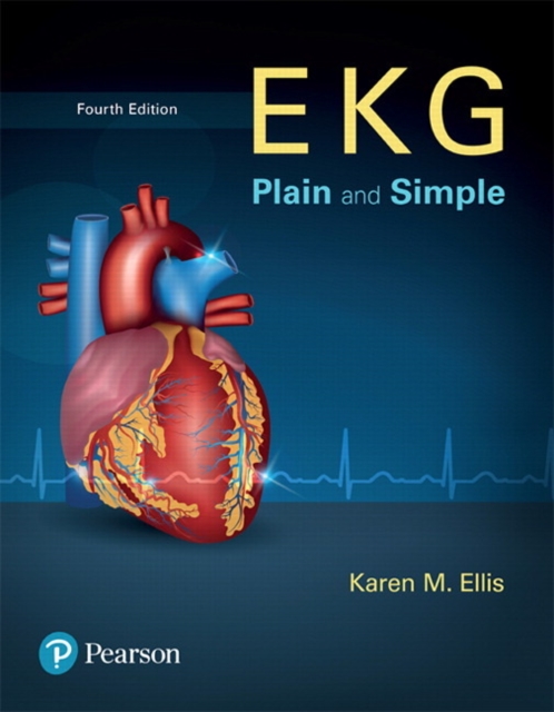 EKG Plain and Simple, Paperback / softback Book