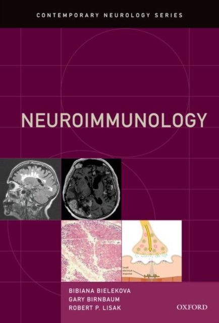 Neuroimmunology, Hardback Book