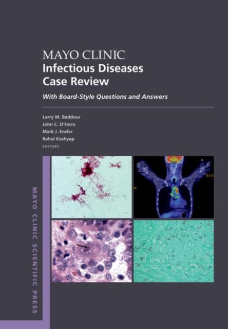 Mayo Clinic Infectious Diseases Case Review : With Board-Style Questions and Answers, Paperback / softback Book
