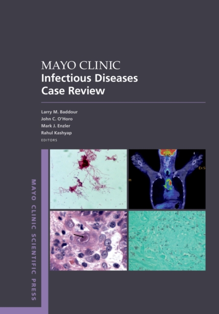 Mayo Clinic Infectious Diseases Case Review : With Board-Style Questions and Answers, PDF eBook