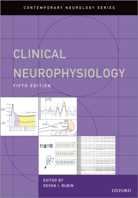 Clinical Neurophysiology, PDF eBook