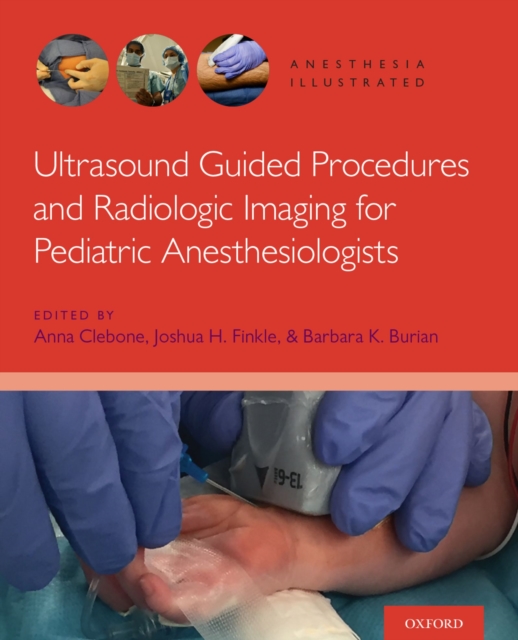 Ultrasound Guided Procedures and Radiologic Imaging for Pediatric Anesthesiologists, PDF eBook