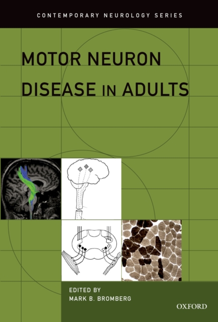 Motor Neuron Disease in Adults, EPUB eBook