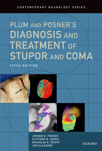 Plum and Posner's Diagnosis and Treatment of Stupor and Coma, PDF eBook