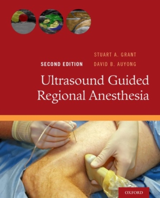 Ultrasound Guided Regional Anesthesia, Paperback / softback Book