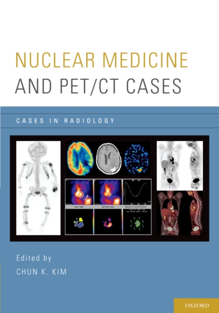 Nuclear Medicine and PET/CT Cases, EPUB eBook