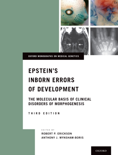 Epstein's Inborn Errors of Development : The Molecular Basis of Clinical Disorders of Morphogenesis, PDF eBook