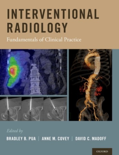 Interventional Radiology : Fundamentals of Clinical Practice, Hardback Book