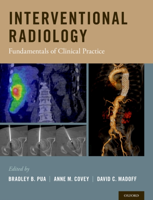 Interventional Radiology : Fundamentals of Clinical Practice, EPUB eBook