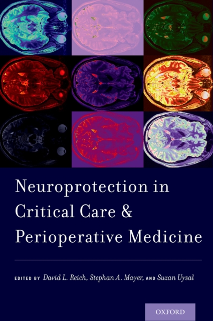 Neuroprotection in Critical Care and Perioperative Medicine, PDF eBook
