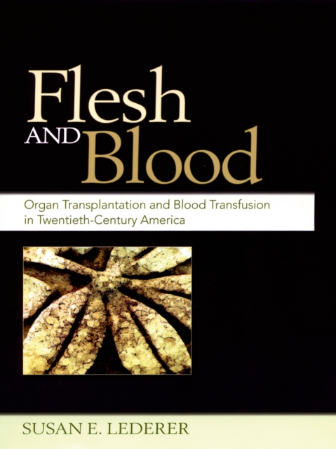 Flesh and Blood : Organ Transplantation and Blood Transfusion in 20th Century America, EPUB eBook