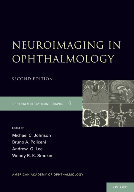 Neuroimaging in Ophthalmology, EPUB eBook