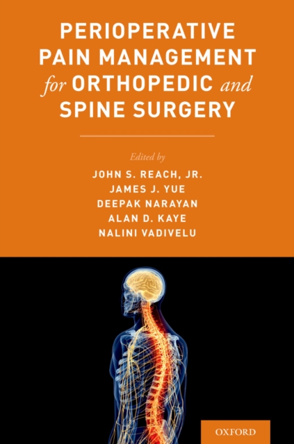 Perioperative Pain Management for Orthopedic and Spine Surgery, EPUB eBook