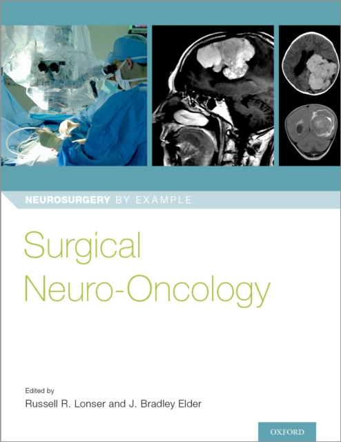 Surgical Neuro-Oncology, PDF eBook