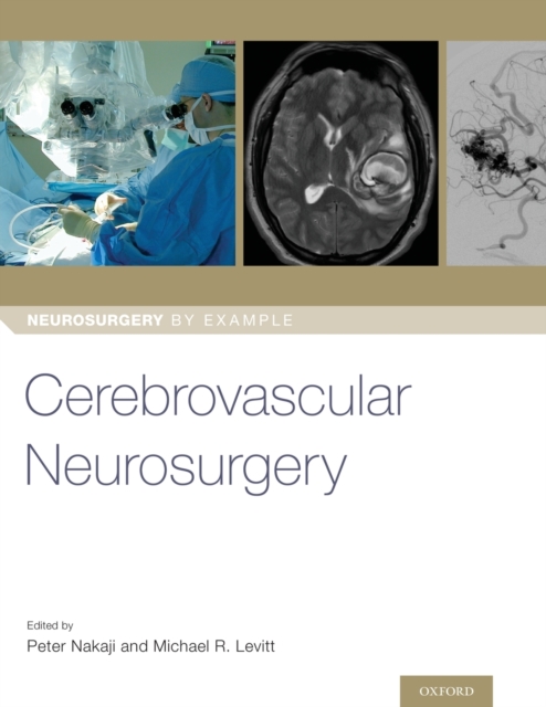 Cerebrovascular Neurosurgery, Paperback / softback Book
