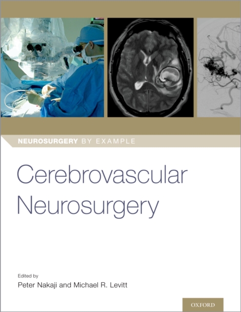Cerebrovascular Neurosurgery, EPUB eBook