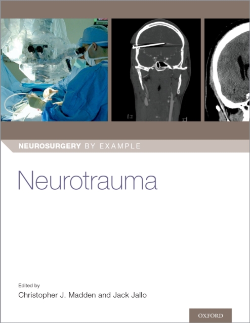 Neurotrauma, PDF eBook