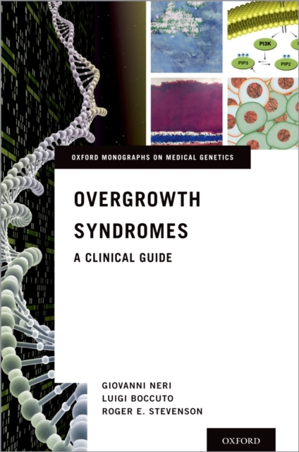 Overgrowth Syndromes : A Clinical Guide, EPUB eBook