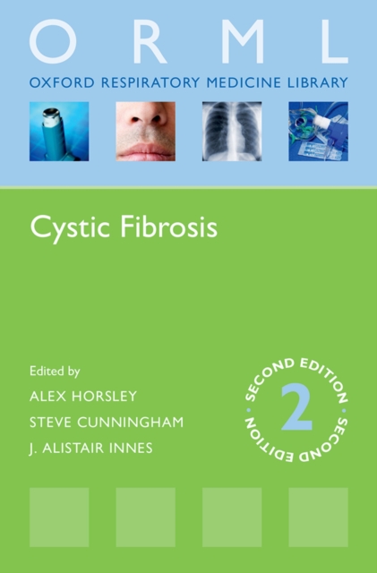 Cystic Fibrosis, PDF eBook