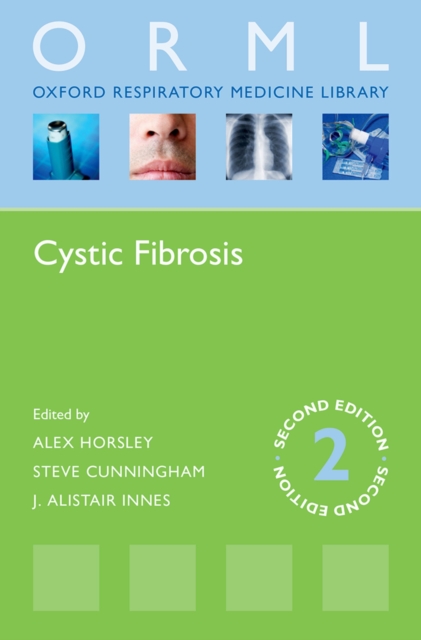 Cystic Fibrosis, EPUB eBook