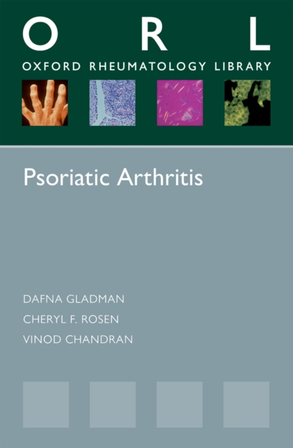 Psoriatic Arthritis, EPUB eBook