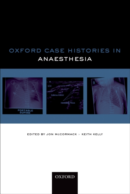Oxford Case Histories in Anaesthesia, PDF eBook