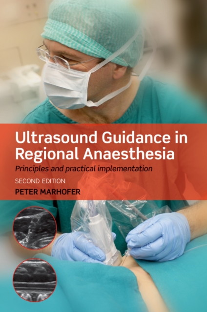 Ultrasound Guidance in Regional Anaesthesia : Principles and practical implementation, EPUB eBook